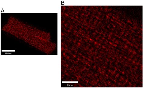 Immunofluorescence labeling of βII tubulin in isolated cardiomyocytes