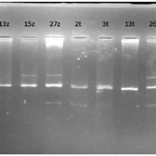 Profile Of Gstm And Gstt Genes By Multiplex Pcr Pm Molecular Weight