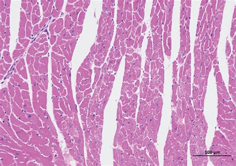 He And Masson Staining Of Rat Myocardial Tissue In Each Group 200x Download Scientific