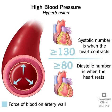 What Does Sys And Dia Mean On A Blood Pressure Machine At Mae Burley Blog