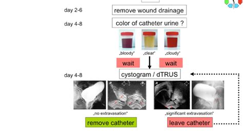 Standardized procedure following RRP | Download Scientific Diagram