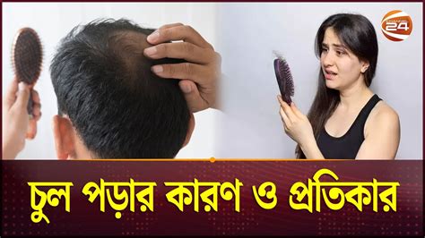 চুল পড়ার কারণ ও প্রতিকার Hair Loss Hair Loss Prevention Hairfall