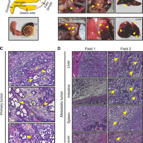 Gross Morphology And Histopathology Of Hapt Orthotopic Tumor A