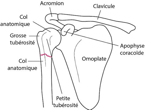 Fracture D Paule Une Douleur Soulag E Par Lost Opathie