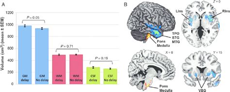 Neuroanatomical Correlates Of History Of Language Development In Asc