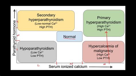 Md559 Summary Of Calcium And Phosphorus Disorders Youtube