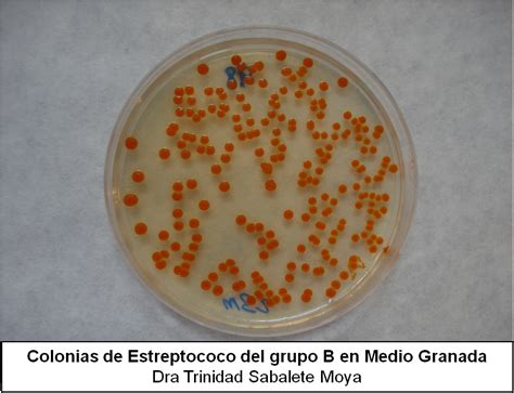 Fundación Io DetecciÓn De Estreptococo Del Grupo B En Embarazadas Cuando Donde Como Y Por QuÉ