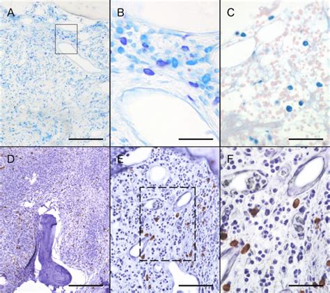 Histological (A-C) and immunohistochemical (D-F) staining of mast cells ...