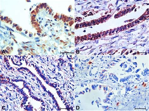 Immunohistochemical Staining For Er Androgen Receptor Vegf And Cox