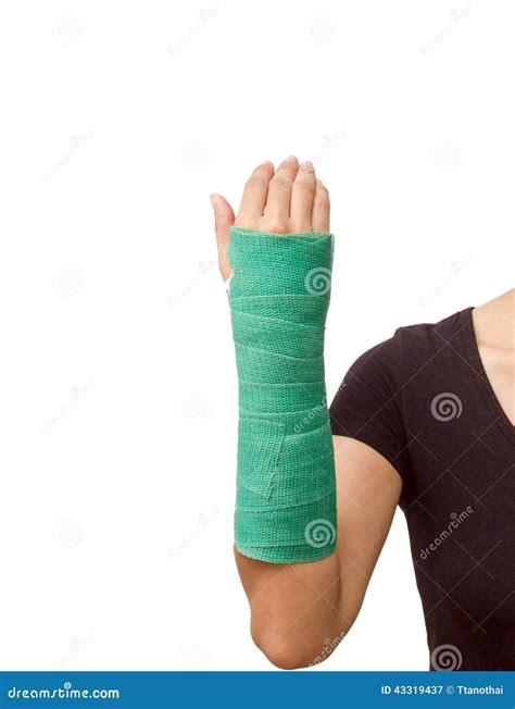 Broken Arm With Green Cast On White Background Stock Photo - Image ...