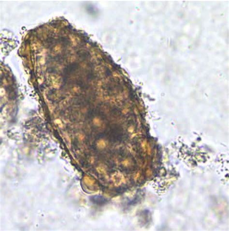 Ascaris Lumbricoides Larvae