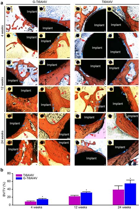 Evaluation Of The Osteogenesis And Osseointegration Of Titanium Alloys