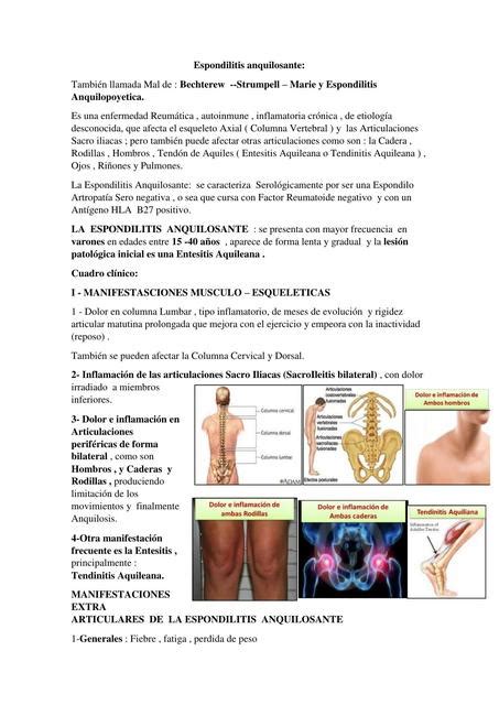 Espondilitis Anquilosante Mathews Tapia Udocz