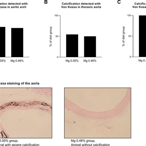 Calcification Of The Aorta Identified By Von Kossa Staining In Download Scientific Diagram