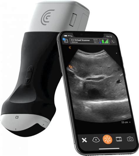 Ecógrafo Clarius HD Syservat Medical