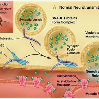 Clostridium Botulinum Pathogenesis