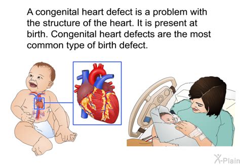 Congenital Heart Defects