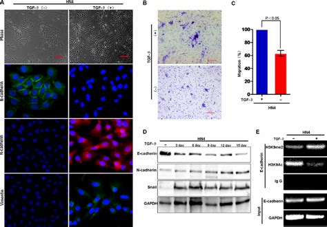 H K Methylation At The E Cadherin Promoter Is Associated With Tgf