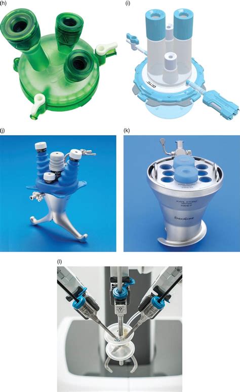 Laparoendoscopic Single Site Surgery Ports Access And