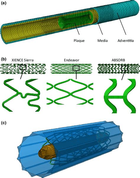 xience sierra stent drug eluting stent xience prime  rs piece