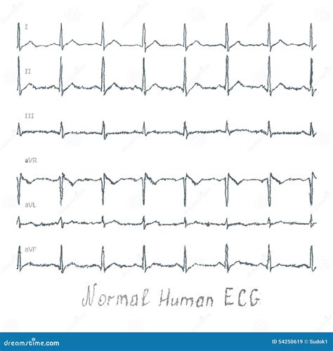 Normal Ecg Human Illustration Stock Illustration Image