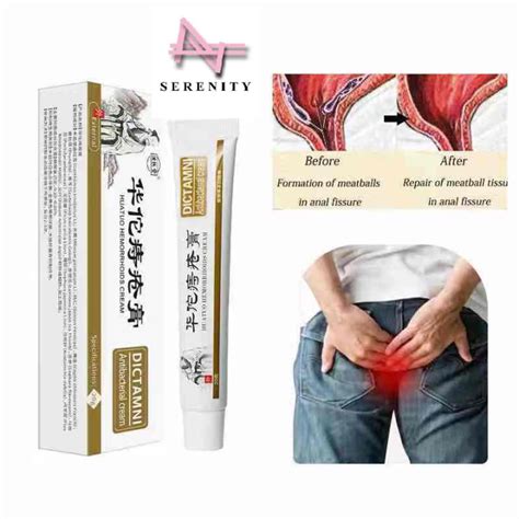 Serenity 20g Chinese Herbal Cream Ointment Antibacterial Hemorrhoids