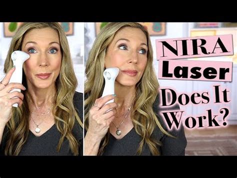 NIRA Precision Laser Review Before After 150 Days YouTube