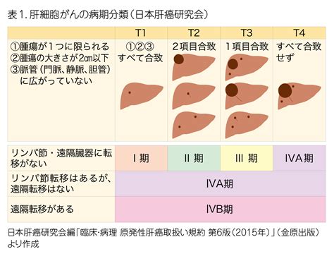 肝細胞がん 【岐阜・岐南町】けやきクリニック：糖尿病内科・血液内科・消化器内科・総合内科 一宮からも通院可