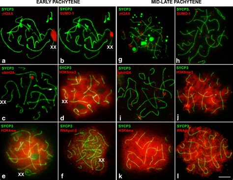 Immunolocalization Of Epigenetic Markers In The Sex Chromosomes Of E