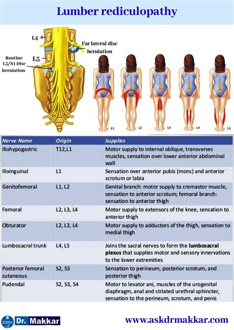 Sciatica Sciatic Nerve Compression Lumbar Radiculopathy Cause Symptoms