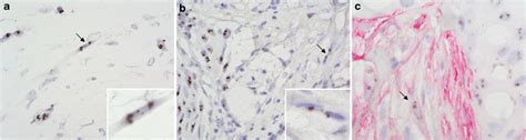 Chromogenic In Situ Hybridization A And B And Simultaneous