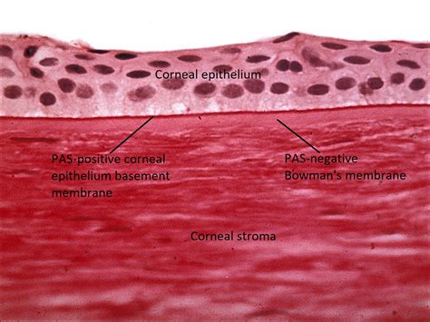 Moran Core Stains And Processing