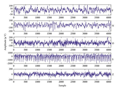 EEG signals from different sets of Bonn University dataset. | Download ...