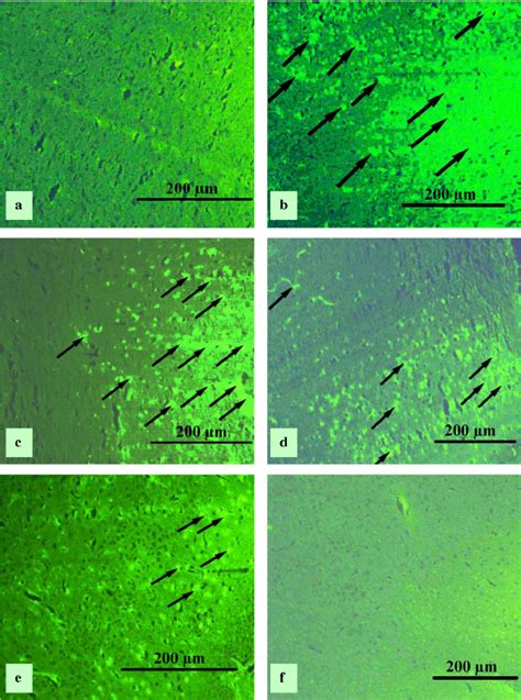 Effect Of Vwe On Glial Fibrillary Acidic Protein Gfap By