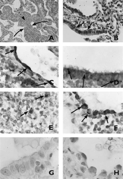 Routine Histopathological Analysis Of Lung Tissue From The Case Report