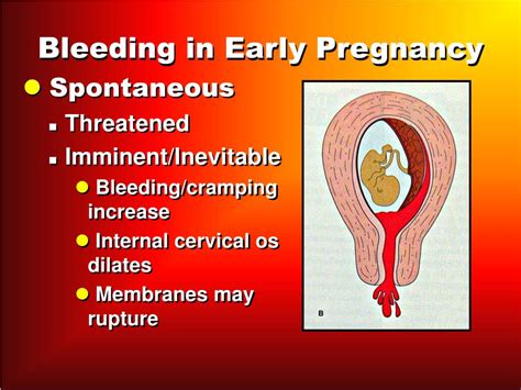 Ppt Hemorrhage Powerpoint Presentation Free Download Id 3559886