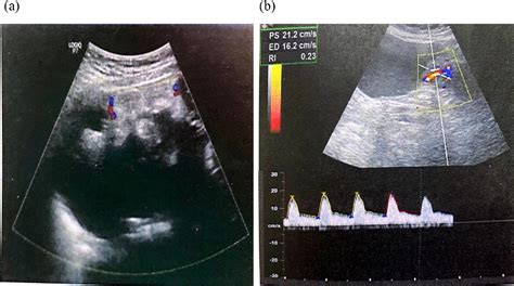 Figure 4 From Diagnostic Utility Of Multiparametric Magnetic Resonance