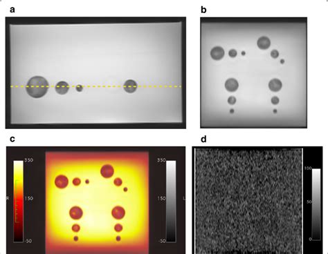 Biopsy Phantom A Axial Side View T Weighted Magnetic Resonance Image