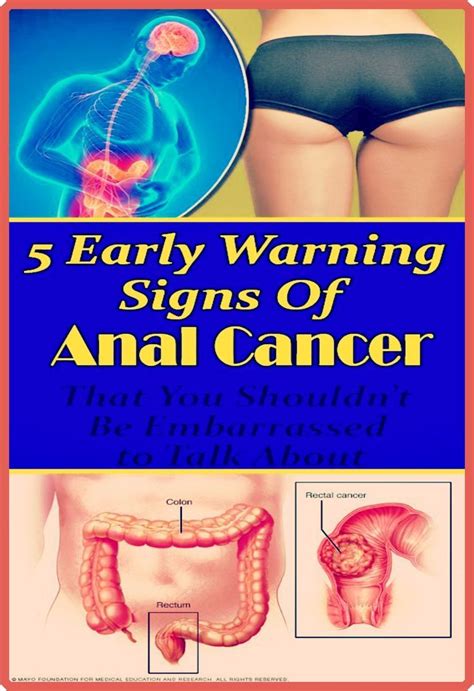 6 Early Warning Signs Of Rectum Cancer Everyone Is Too Embarrassed To