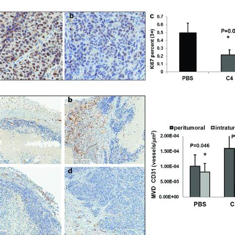 A Proliferation Of Tumor Cells Was Reduced In Miapaca 2 Xenograft