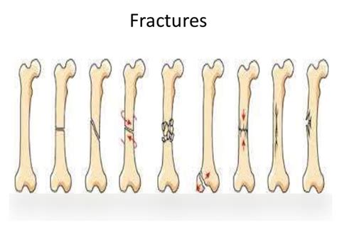 Anatomy And Physiology Study Guide Diagram Quizlet