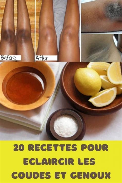 20 Recettes Naturelles Pour Eclaircir Les Coudes Et Genoux Noirs