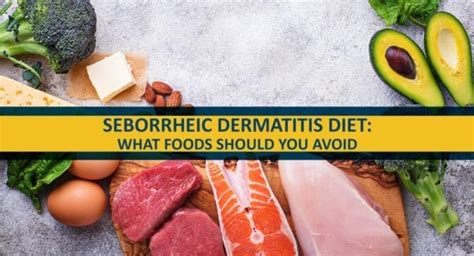 Seborrheic Dermatitis Diet: What Food Do You Need to Avoid