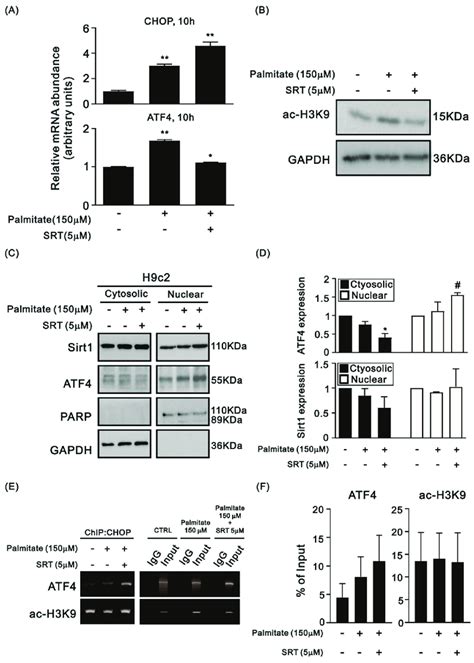 Effects Of SRT1720 On CHOP And ATF4 In The H9c2 Cells Treated With PA