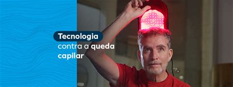 Tecnologia Contra A Queda Capilar Dispositivos De LEDterapia Capellux