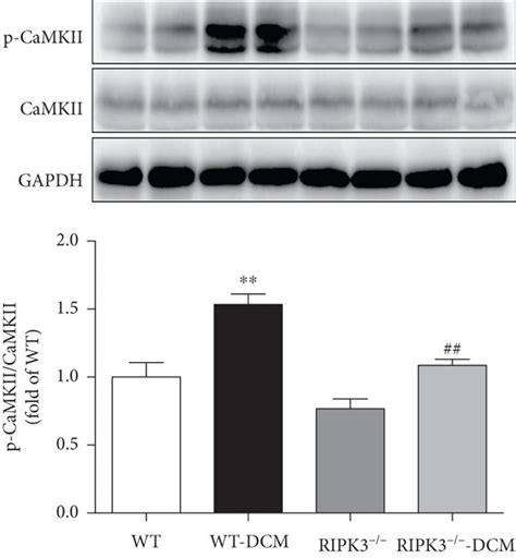 Ripk Deficiency Decreases Ripk Expression Mlkl Phosphorylation And