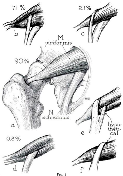 Figure 1 From New Method For High Resolution Mri Imaging Of Proximal