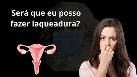 Nova Regra Simplifica Processo De Laqueadura Mas Mulheres Ainda