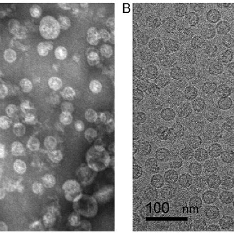 Characterization Of Purified Vlps A Transmission Electron Microscopy