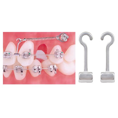 Crimpable Split Curved Hooks Ortho Technology